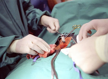 Choosing Treatments for Pancreatic Cancer Symptoms